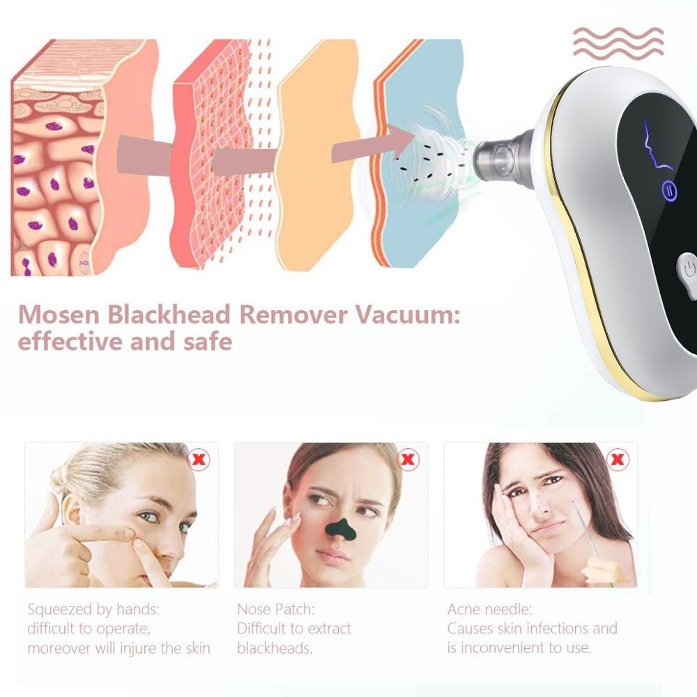 Mini mitesszer eltávolító (5)